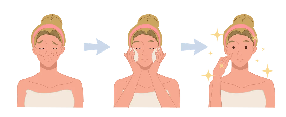 Clear face treatment procedure  Illustration