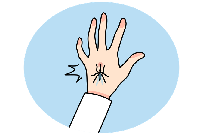 Mosquito bite person hand  Illustration