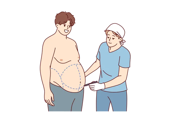 Préparation à la liposuccion pour homme obèse qui souhaite se débarrasser de son excès de poids et de son ventre affaissé  Illustration